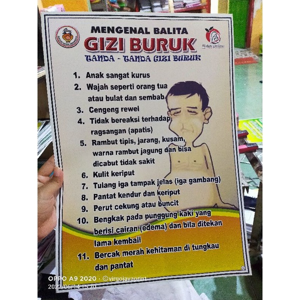 

POSTER MENGENAL BALITA GIZI BURUK (75)