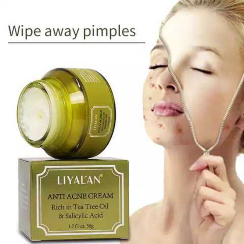 Jual Krim Penghilang Bekas Luka Bekas Jerawat / Acne Scars Removal ...