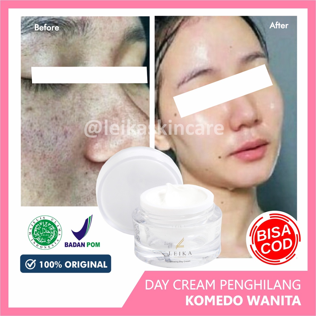 Krim Penghilang Komedo dan Jerawat di Hidung Cocok untuk Pria Wanita Krim penghilang komedo hitam membandel di hidung di wajah Glowing Day Cream Leika Skincare 10gr Korea Ampuh 100% Halal MUI Resmi BPOM