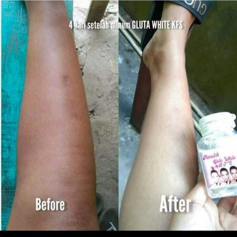 kfs/susu_gluta_whitening