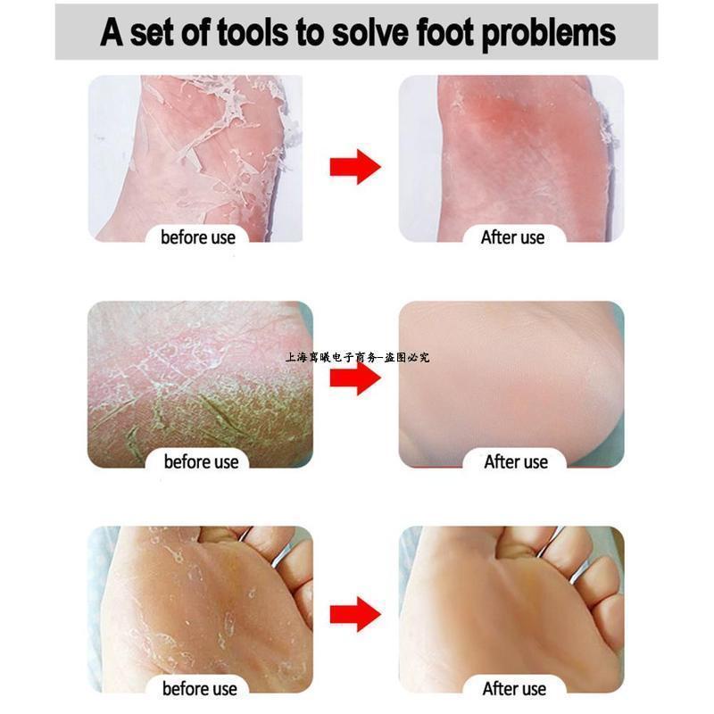 Kikir Amplas kaki untuk mengikis kulit mati kaki pecah jadi mulus parutan telapak kaki Alat