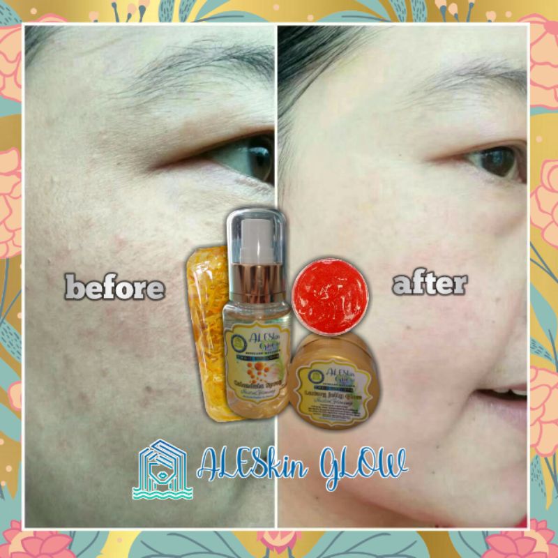 LUXURY ARBUTIN JELLY ALESKIN GLOW Skincare Glowing-Paket Perawatan Wajah Korea-Cream Glowing