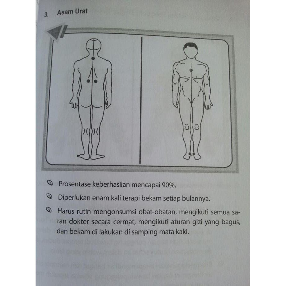 Buku Bekam Panduan Bergambar / Panduan Bekam Bergambar