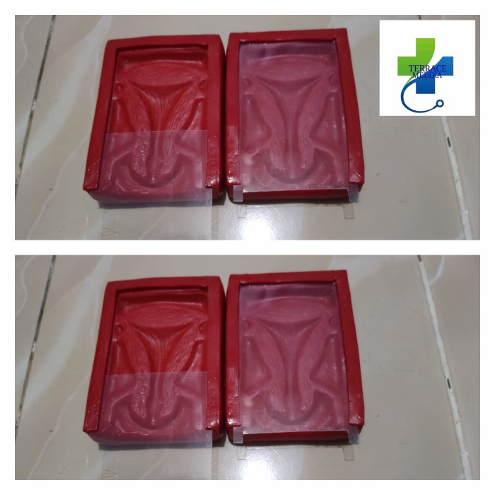 Phantom manikin / Alat peraga / IUD KOTAK MERAH