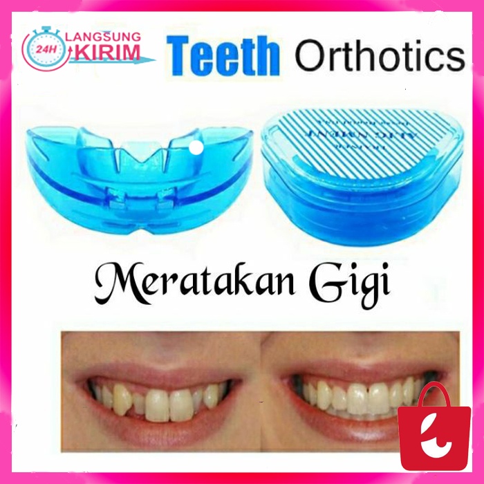 [BISA COD] Alat Perapi Gigi Karet Biru Perata Gigi Pelurus Gigi Teeth Trainer Alignment Original