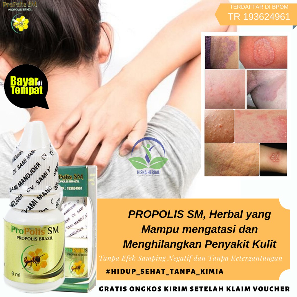 Cara Mengobati Gatal Jamur Di Bokong Secara Alami - Dunia Herbal