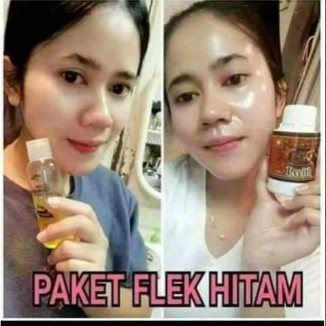 PAKET FLEK HITAM NASA