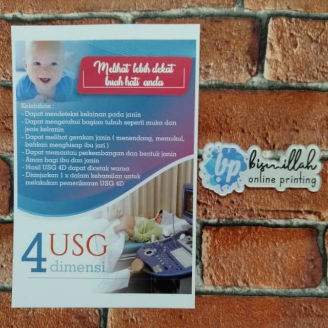 Poster USG 4 dimensi