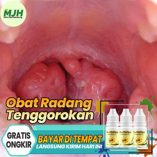 Jual Obat Radang Tenggorokan Infeksi Tenggorokan Amandel Bengkak Parah ...