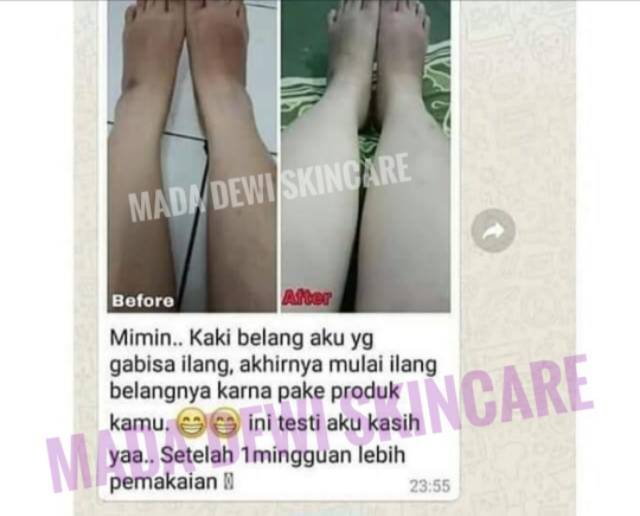 [COD] PAKET PLATINUM 3X DOSIS HB CHERRY SIANG DAN MALAM HB PEMUTIH BADAN DOSIS TINGGI SUPER DOSTING