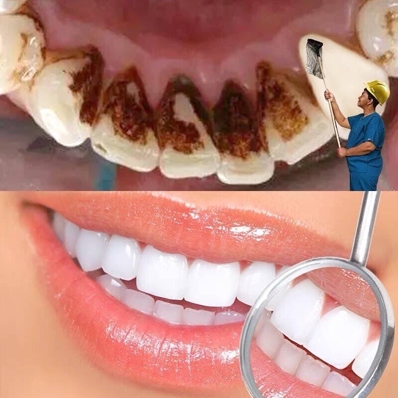 O'RANNLE ORIGINALE PEMUTIH GIGI TEETH WHITENING  DAN ACTIVED CHARCOAL POWDER ORIGINAL