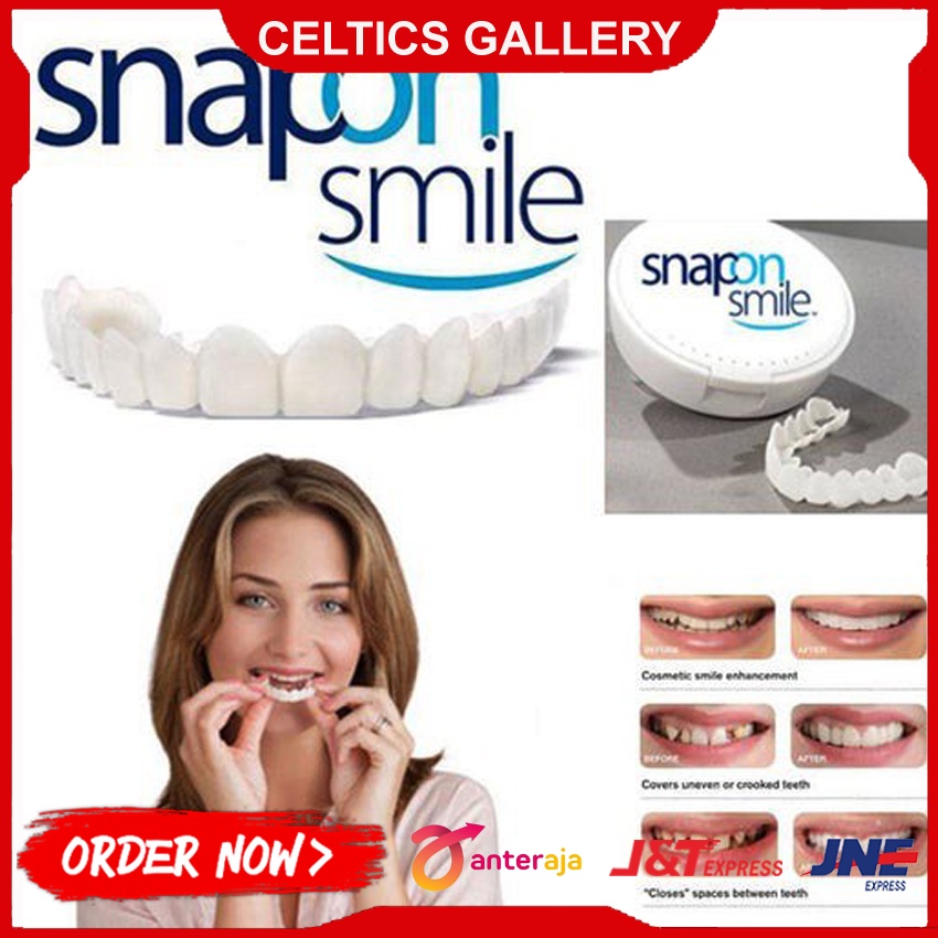 Veneer Gigi Palsu Instan Atas Bawah Original | Snap On Smile Veneers Original 100%