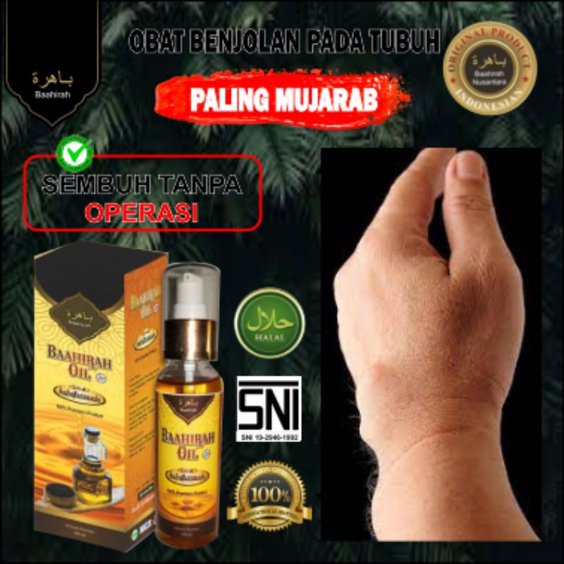 [MINYAK OLES BAAHIRAH OIL]- BENJOLAN GONDOK - OBAT BENJOLAN LIPOMA - KANKER - UCI UCI -