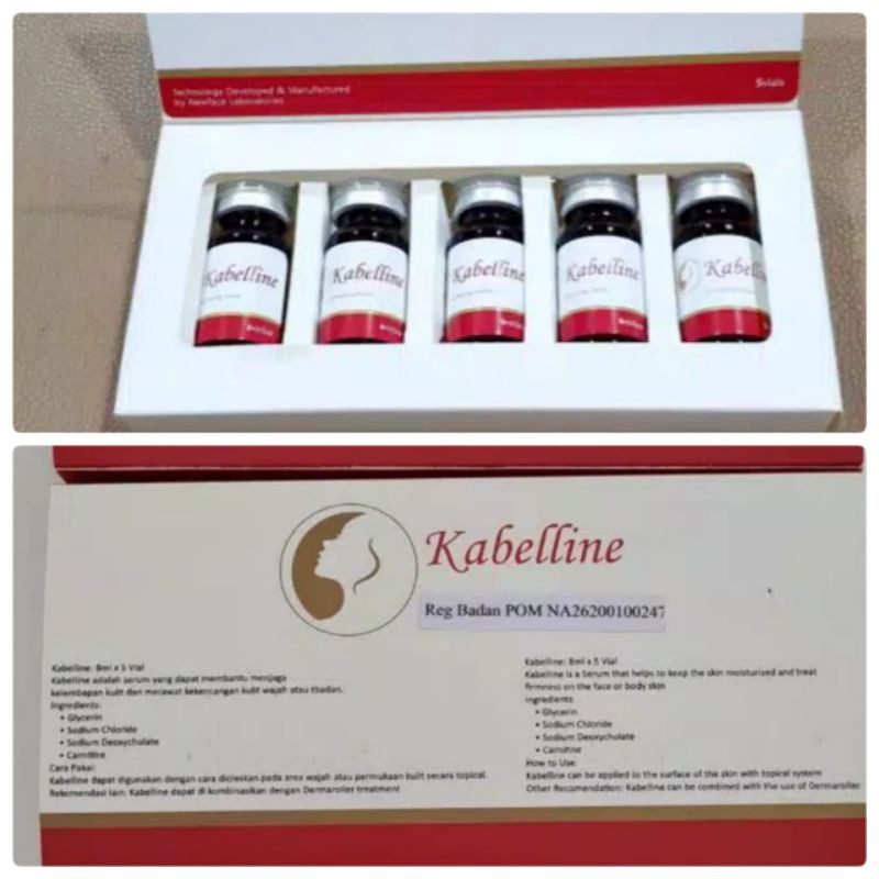 

kabelline