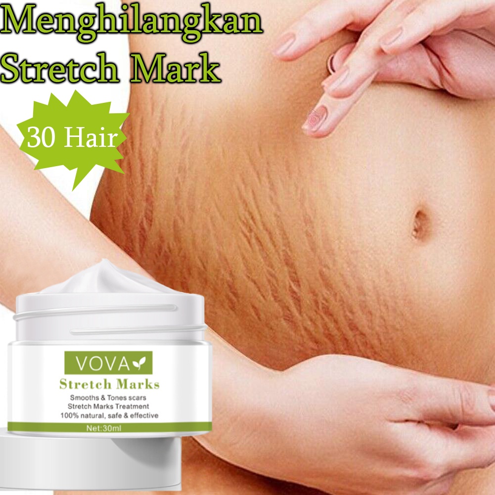 Stretch mark cream Krim Penghilang bekas luka  Krim Kehamilan Hilangkan stretch mark Obat Penghilang Strechmark Paling Ampuh Untuk Ibu Hamil Setelah Melahirkan Mama's Choice