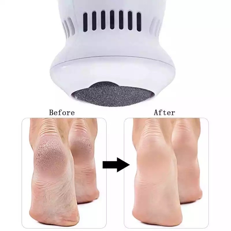 Electric Foot Polisher