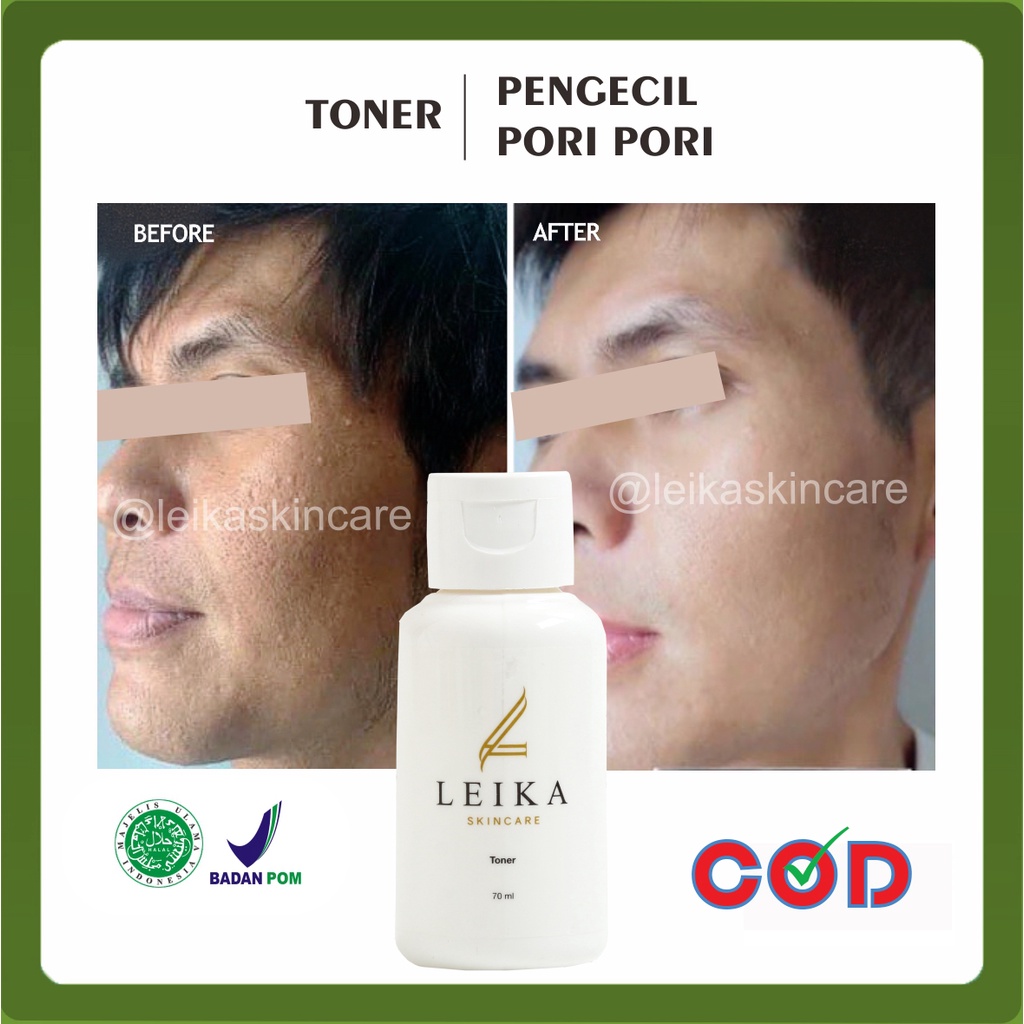 PROMO LEIKA TONER PENGECIL PORI-PORI PENGHALUS PORI-PORI PRIA TERBUKTI AMPUH MENGECILKAN PORI-PORI W