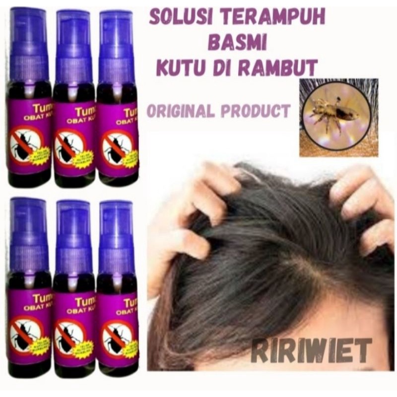 Obat Penghilang Telur Kutu Lisa Rambut Paling Ampuh