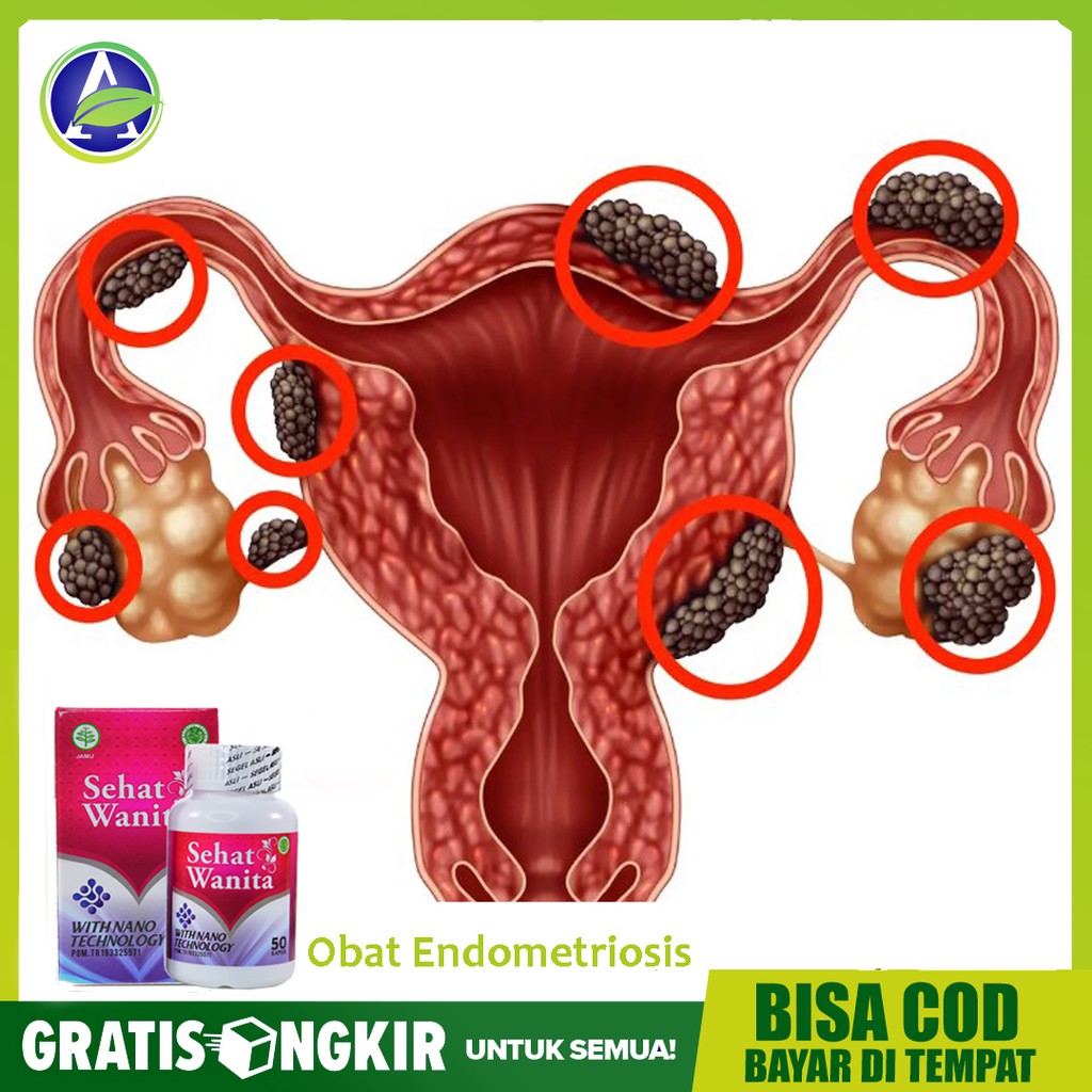 Obat Endometriosis, Kista Endometriosis, Kista Coklat Sehat Wanita 50 Kapsul ASLI - Bisa COD
