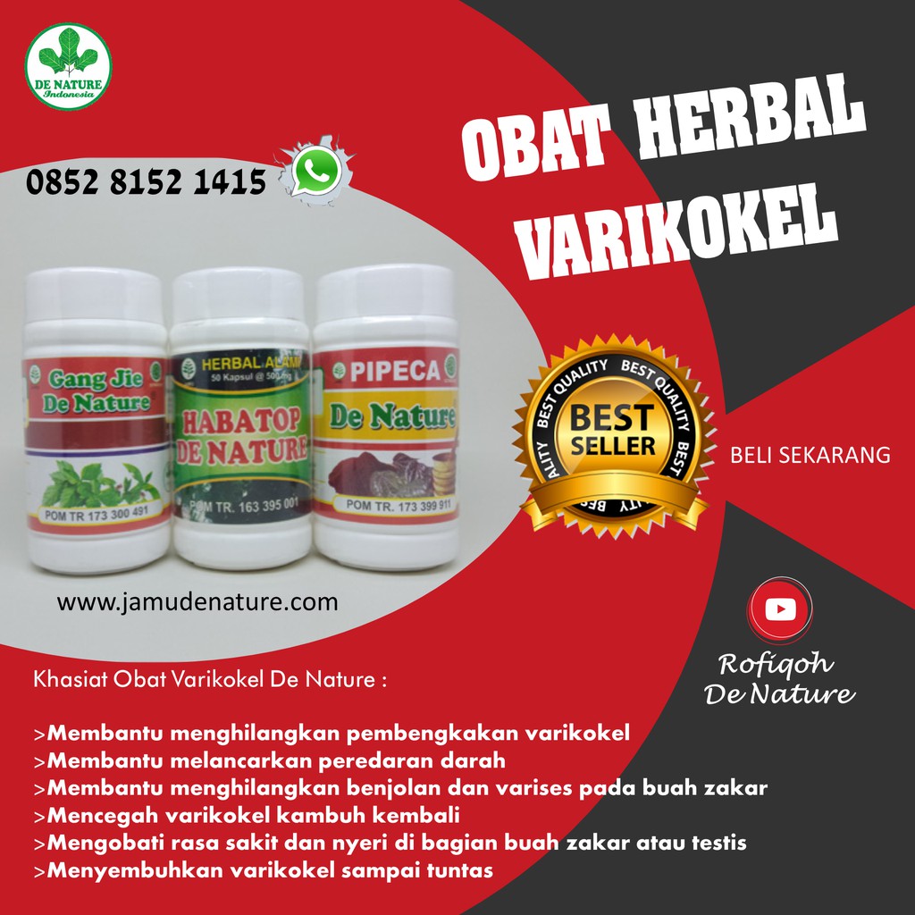 Obat Alami Varikokel Ringan