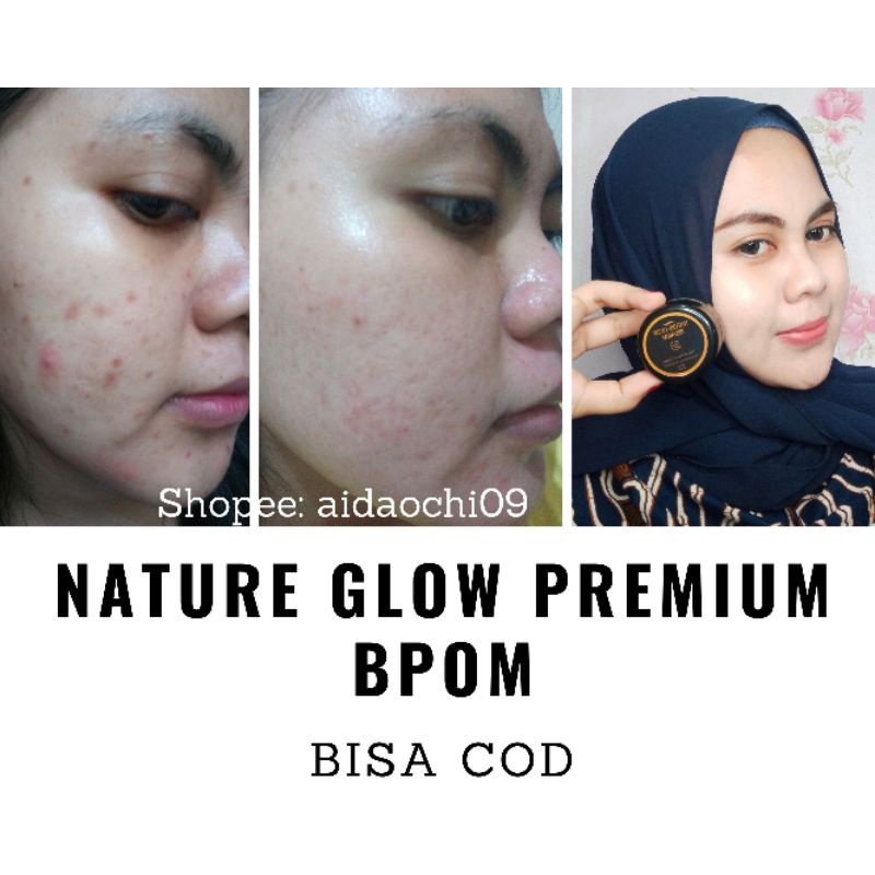 KRIM PEMUTIH WAJAH BPOM CREAM FLEK HITAM NATURE GLOW PREMIUM