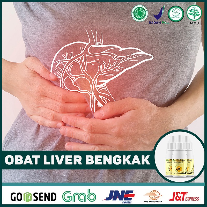 

Obat Liver Bengkak Perut Sirosis Hepatitis A B C Herbal Asli Terlaris Propolis SM Di Surabaya