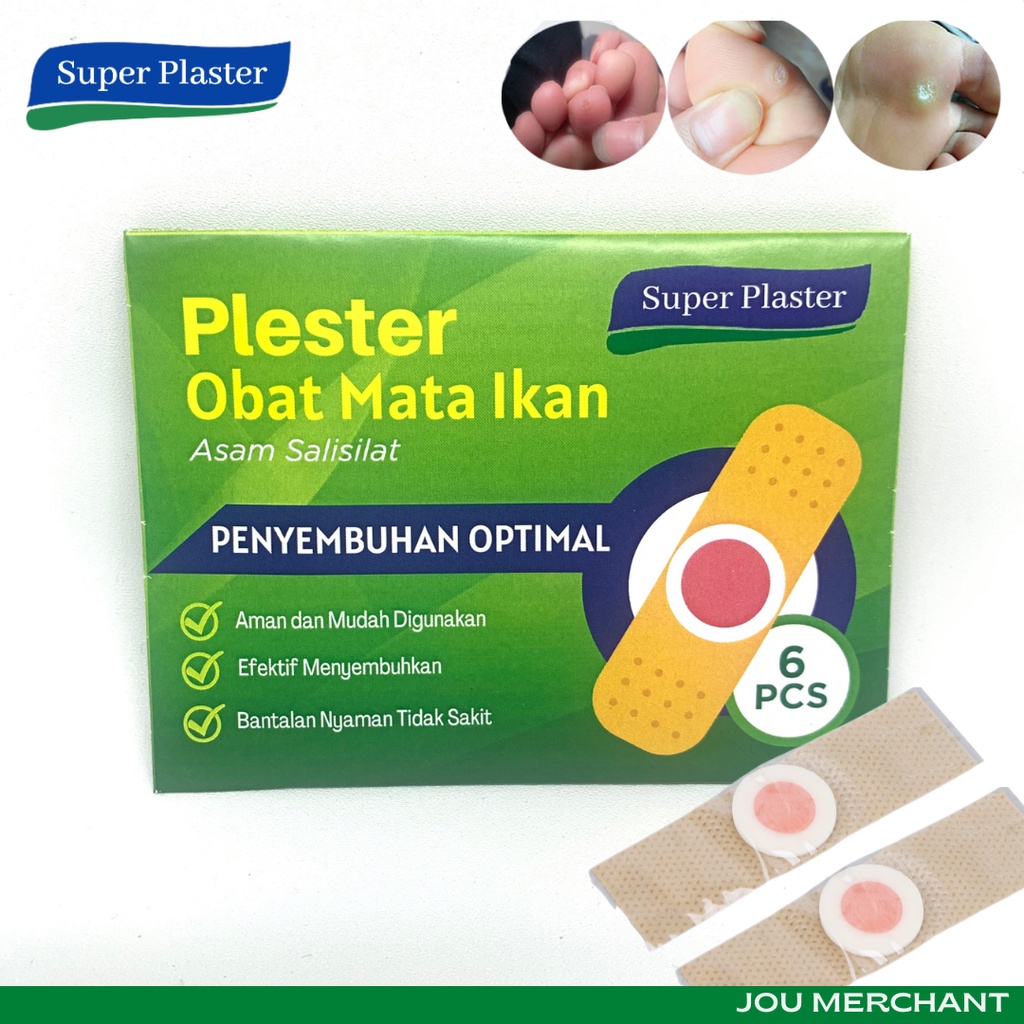 Super Plaster Mata Ikan / Obat Kutil / Kapalan / Foot Corn Remover / Callus - Kemasan Pack isi 6 Plaster ORIGINAL AMPUH