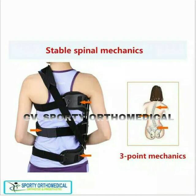 Korset Skoliosis/Tulang belakang bengkok