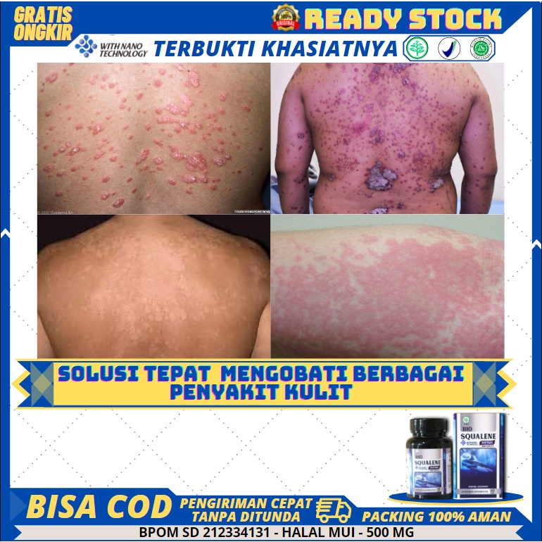 Harga Obat Hapur Kurap Terbaru November 2021 Biggo Indonesia