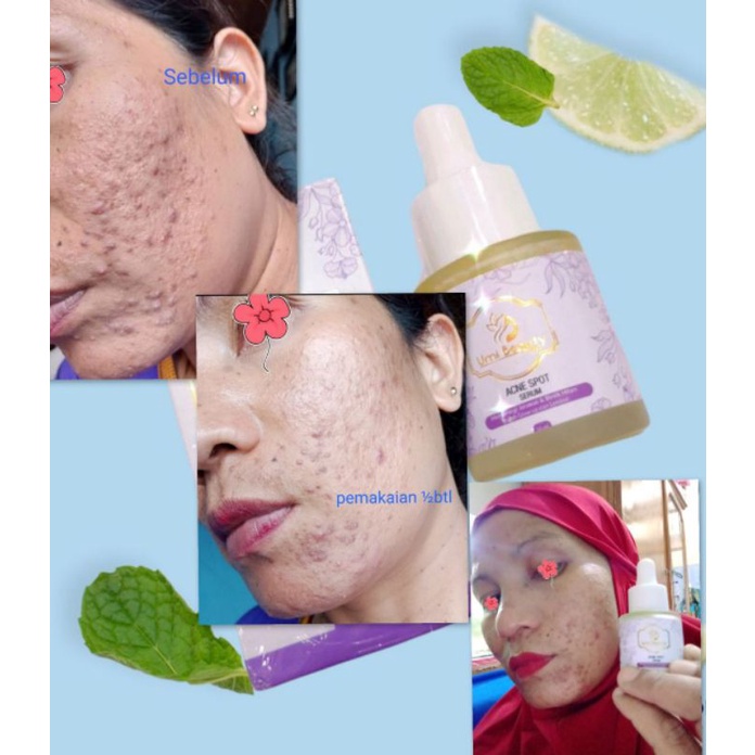 UBC SKINCARE PAKET KOMPLIT UMI BEAUTY CARE