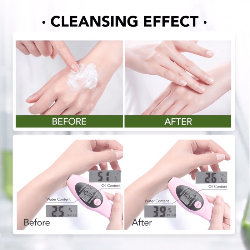 YOU ACNEPLUS LOW PH CALMING CLEANSER 100gr