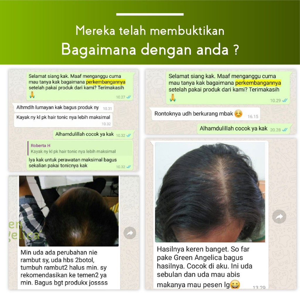 Suplemen Penumbuh Rambut Kepala Botak Rontok Dalam 2 Minggu Teruji Bpom Shopee Indonesia