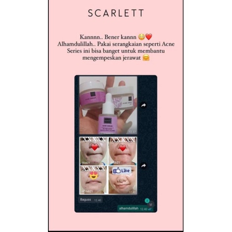[ COD ] SCARLETT WHITENING FACE CARE / PERAWATAN WAJAH-5