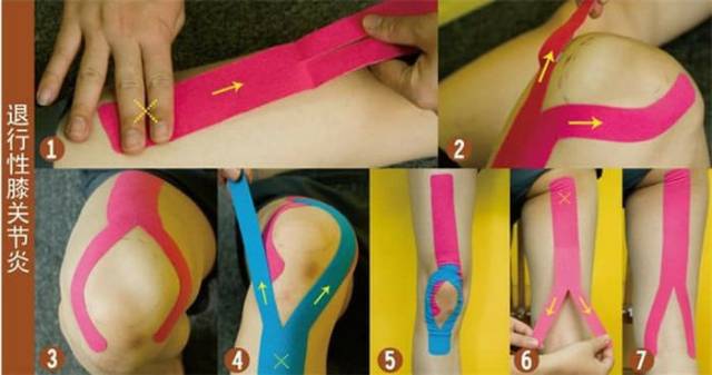 Kinesio Tape Taping  5cm X 5M