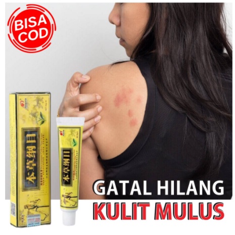 Cream Eksim Kulit Gatal  Psoriasis Jerawat Ruam Jamur Kudis Kurap Kutu Air Obat Kulit Gatal Anti bakteri Anti Gatal Krim Kulit Psoriasis Dermatitis Eksim (SALEP KUNING) 15g