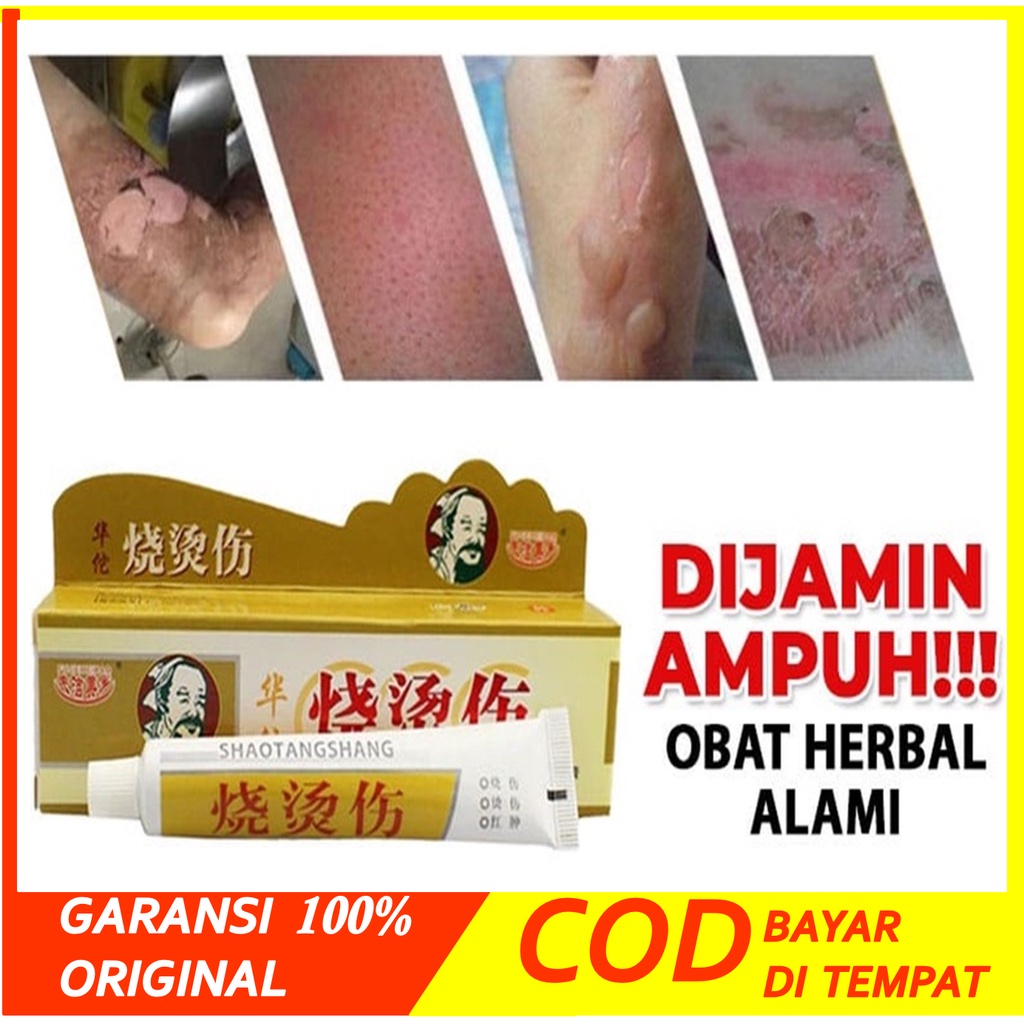[ BISA COD ] Huatuo Salep Herbal Obat Luka Bakar & Kena Air Panas / Minyak Panas Kulit Melepuh Ampuh