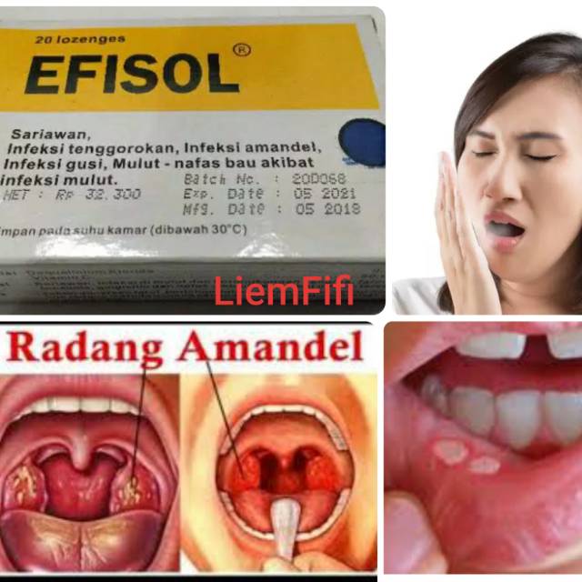 Efisol Tablet Hisap Untuk Sariawan Radang Tenggorokan Shopee Indonesia