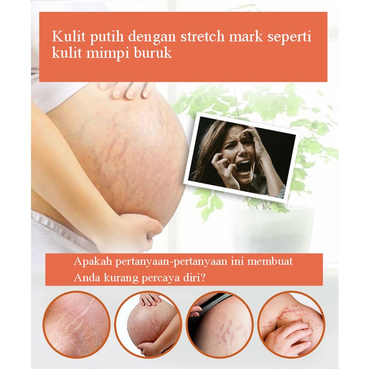 Stretch Mark Cream 45g / Penghilang Stretch Mark / Stretch Marks Pilihan Ibu / BPOM Penghilang Stretch Mark Ampuh / Mengencangkan kulit, mengembalikan kehalusan dan elastisitas