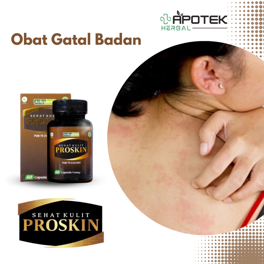 Obat Gatal Badan, Obat Gatal Alergi, Obat Gatal Biduran, Obat Gatal Infeksi Jamur, Obat Gatal Eksim,