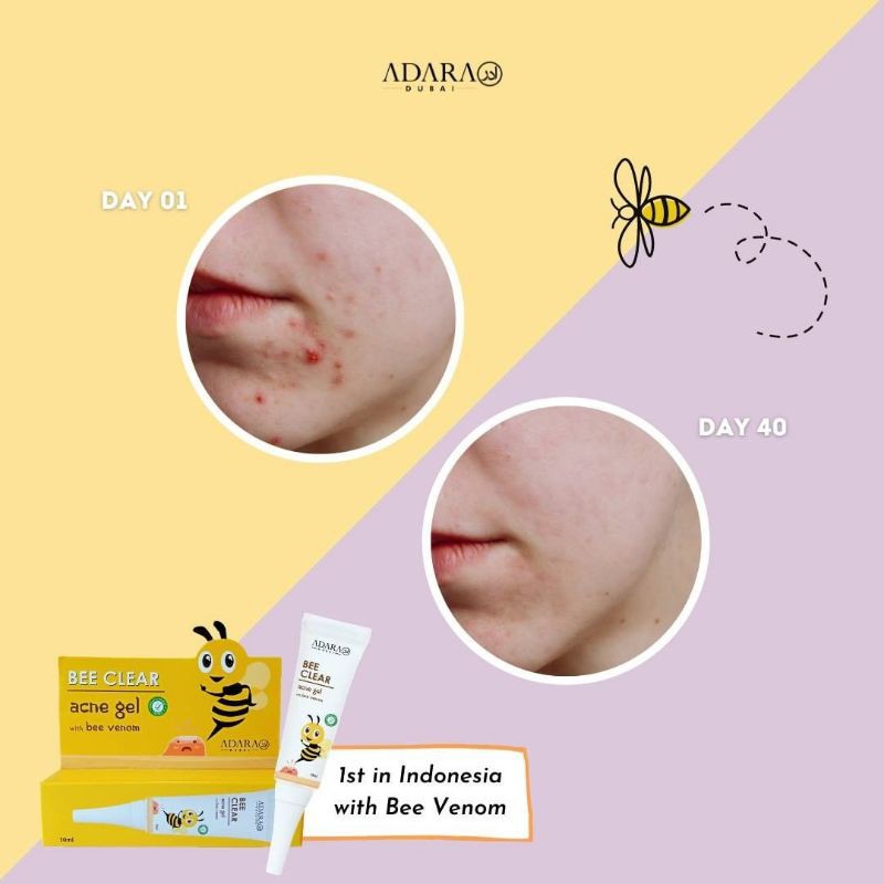 bee acne gel