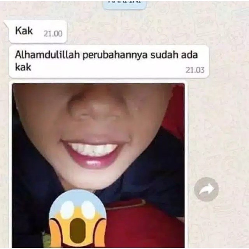 CAIRAN PEMUTIH GIGI KUNING KERANG PENGHILANG KARANG PLAK PERMANEN AMPUH TEETH WHITENING ODOL PASTA