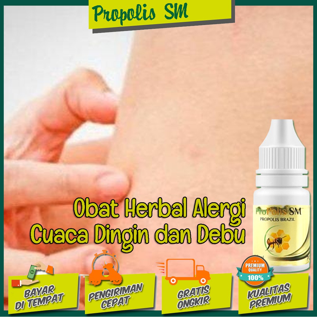 Obat Herbal Alergi Cuaca Dingin dan Debu - Biduran Akibat Udara Dingin Propolis SM Original