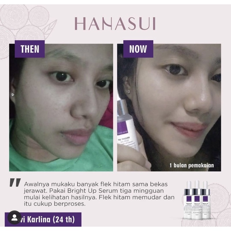 BPOM serum wajah implora ORIGINAL WHITENING ACNE GLOW