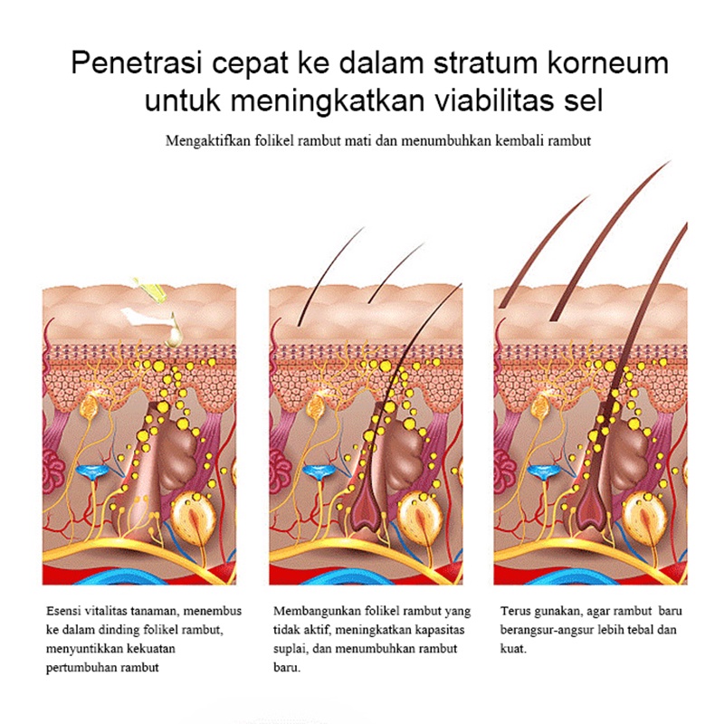 【O'RANNLE】Ekstrak Jahe Murni Mengentalkan Rambut Bayi dan Dewasa, Jenggot, Kumis, Jenggot, Alis Vitamin jahe rambut  Vitamin rambut Pertumbuhan rambut  Musuh botak   Cairan penumbuh rambut  Cairan pertumbuhan