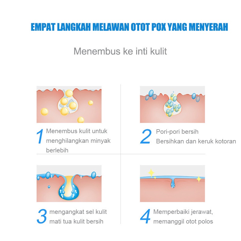 【Barang baru】cream jerawat krim jerawat Lembut dan aman alat jerawat Unisex cream untuk jerawat obat totol jerawat Jerawat Removal ​of Acne Cream Menghilangkan jerawat dengan cepat 30ml