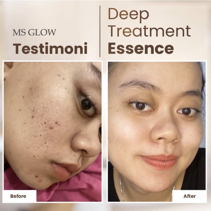 Ms Glow Deep Treatment Essence Salmon DNA