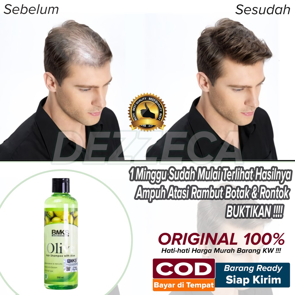 Perawatan Rambut Rontok dan Penumbuh Rambut Cepat Ampuh BPOM Untuk Pria & Wanita SHAMPO BMKS OLIVE