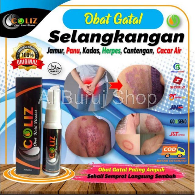 OBAT GATAL SELANGKANGAN EKSIM KULIT KUTU AIR JAMUR PANU KADAS KURAP KEPALA BOROK PALING AMPUH COLIZ