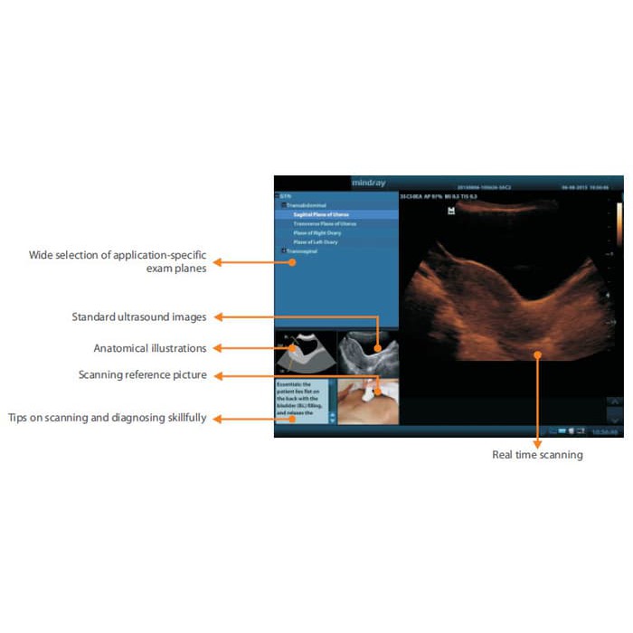 BIG SALE Mindray DP-10 DP10 Power Alat USG 2D 2 Dimensi Versi Terbaru