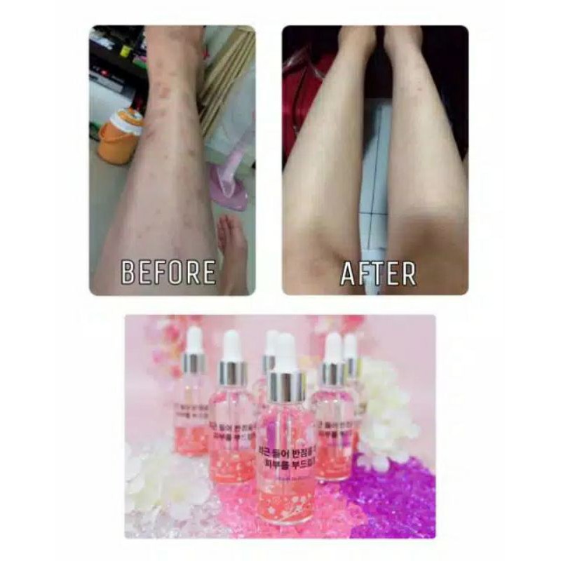 Cherry Blossom Season Serum Penghilang Bekas Luka